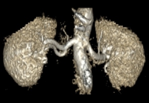 联影医疗获得发明专利授权：“磁共振血管成像方法、装置、电子装置和存储介质”