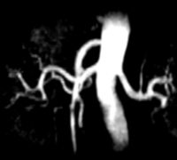 联影医疗获得发明专利授权：“磁共振血管成像方法、装置、电子装置和存储介质”