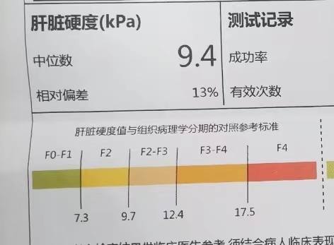 百洋医药：扶正化瘀片是国家医保和基药品种在抗肝纤维化领域占据领先地位