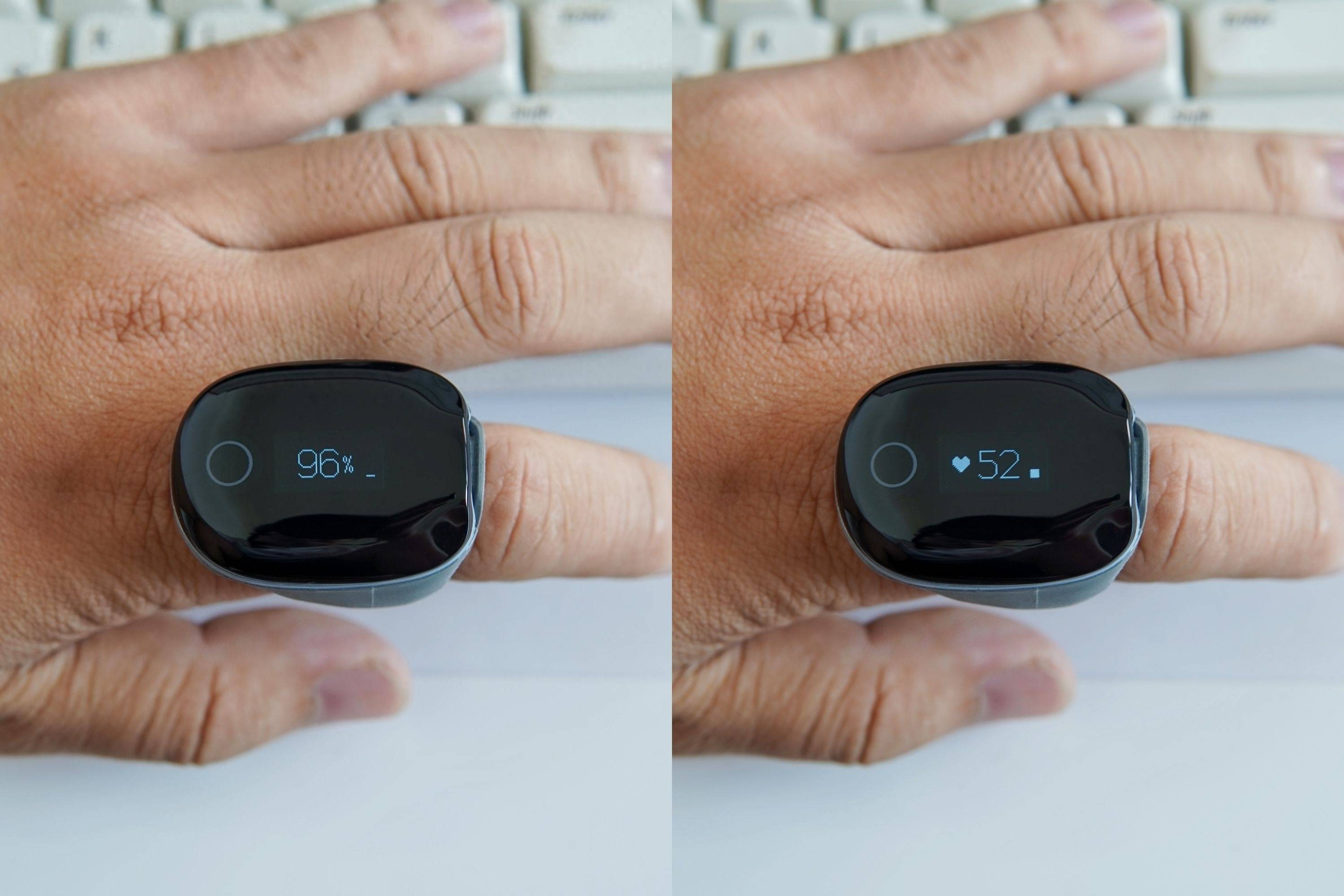 鱼跃医疗获得实用新型专利授权：“一种指环脉搏血氧仪”