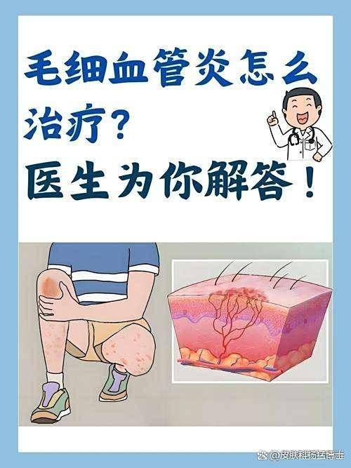 警惕基孔肯雅热！广东佛山已超千例感染