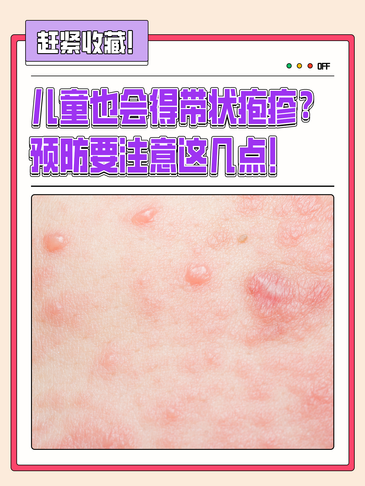 智飞生物获得发明专利授权：“一种用于水痘-带状疱疹病毒感染的重组腺病毒疫苗”