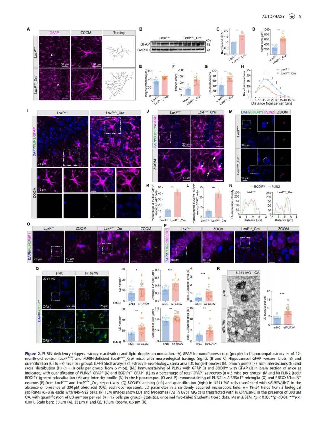 研究显示改善空气质量或有助于预防阿尔茨海默病