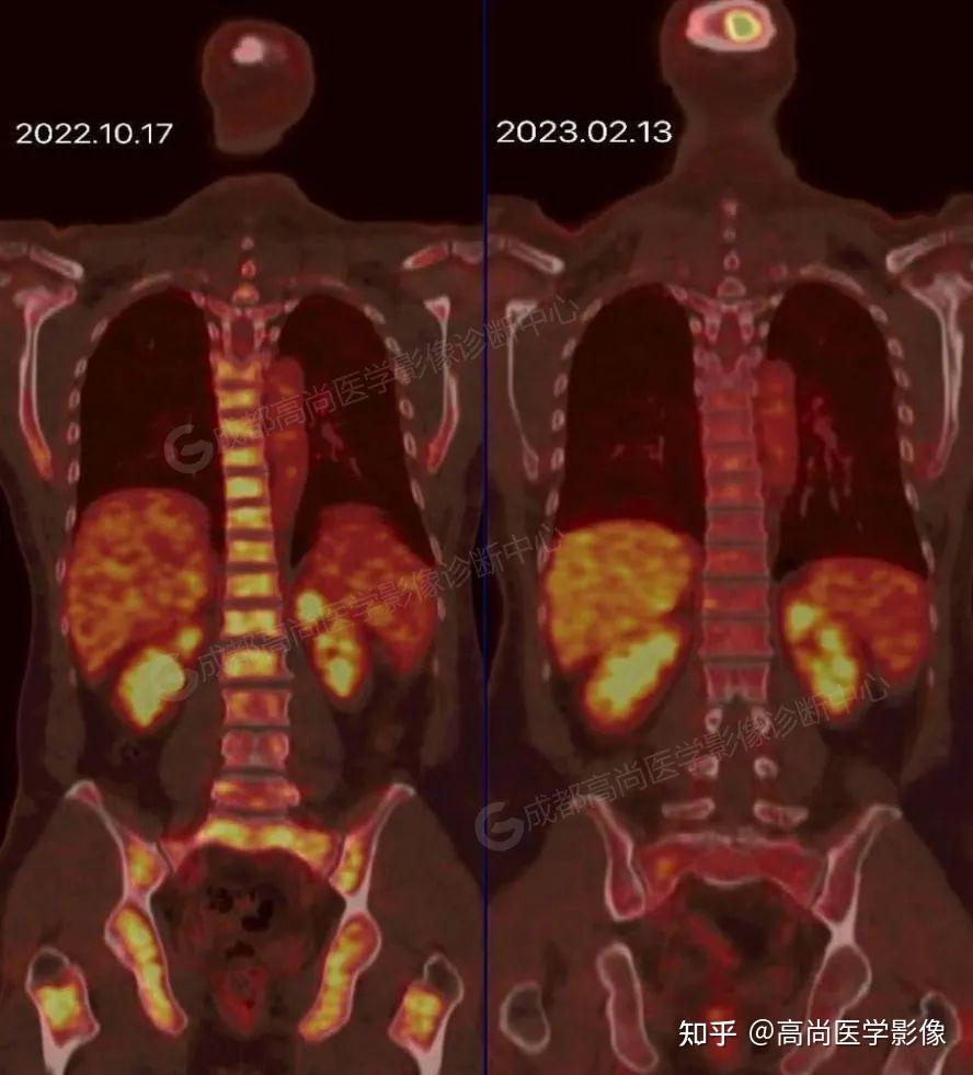 新研究用医学CT技术帮助揭示地震历史