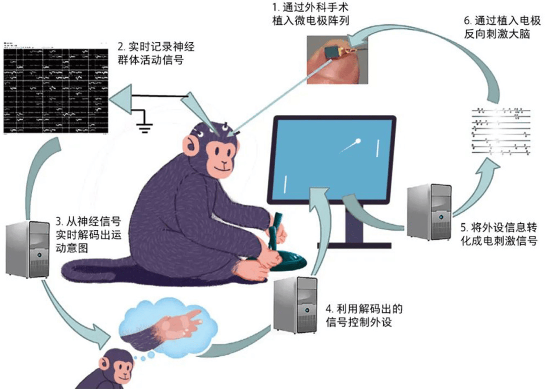 布局脑机接口，加速未来产业落地生花